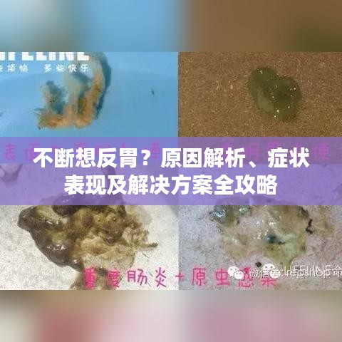 不断想反胃？原因解析、症状表现及解决方案全攻略