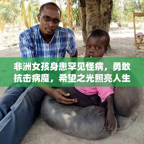 非洲女孩身患罕见怪病，勇敢抗击病魔，希望之光照亮人生路